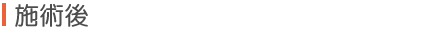 施術後